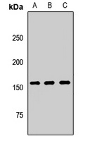 GIGYF2 Rabbit Polyclonal Antibody