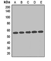 TCP1 eta Rabbit Polyclonal Antibody