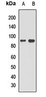 CDT2 Rabbit Polyclonal Antibody