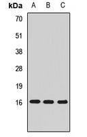 MED21 Rabbit Polyclonal Antibody