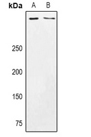 CSMD3 Rabbit Polyclonal Antibody