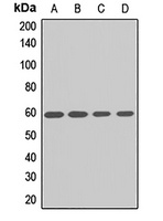 IP6K1 Rabbit Polyclonal Antibody