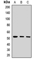 PORCN Rabbit Polyclonal Antibody