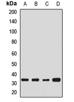 TRAX Rabbit Polyclonal Antibody