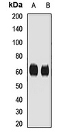 CD55 Rabbit Polyclonal Antibody