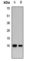 PLA2G2A Rabbit Polyclonal Antibody