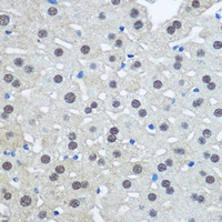 UBA1 Antibody