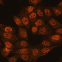 UBA1 Antibody