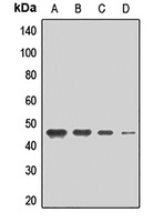 MCT2 Rabbit Polyclonal Antibody