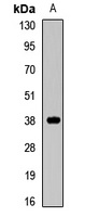 MFF Rabbit Polyclonal Antibody