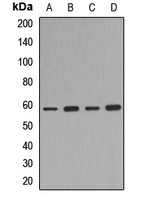 MITF Rabbit Polyclonal Antibody