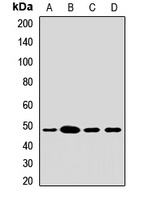ACADL Rabbit Polyclonal Antibody