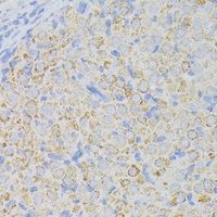 ACADL Rabbit Polyclonal Antibody