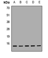 UQCRB Rabbit Polyclonal Antibody