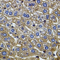 CETP Rabbit Polyclonal Antibody