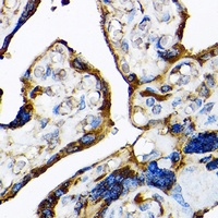CD283 Rabbit Polyclonal Antibody