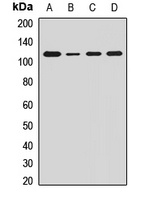 Ah Receptor Rabbit Polyclonal Antibody