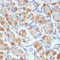 Ah Receptor Rabbit Polyclonal Antibody