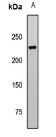 TET1 Rabbit Polyclonal Antibody