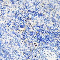 TET1 Rabbit Polyclonal Antibody