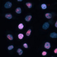 TET1 Rabbit Polyclonal Antibody