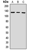 UPF1 Rabbit Polyclonal Antibody