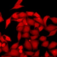 UPF1 Rabbit Polyclonal Antibody