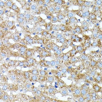 Haptoglobin Rabbit Polyclonal Antibody