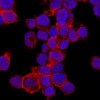 CD11a Rabbit Polyclonal Antibody