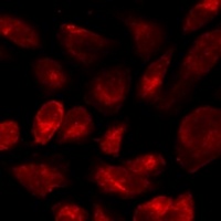 CD46 Rabbit Polyclonal Antibody