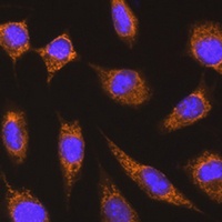 KNG1 Rabbit Polyclonal Antibody
