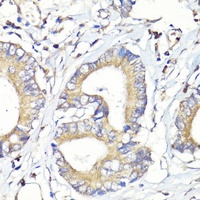 HBEGF Antibody