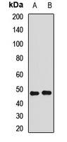 ERR alpha Rabbit Polyclonal Antibody