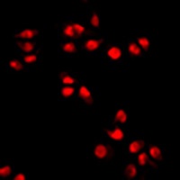 ERR alpha Rabbit Polyclonal Antibody