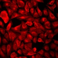 POLR2J Rabbit Polyclonal Antibody