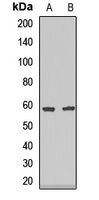Endothelial Lipase Rabbit Polyclonal Antibody