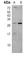 CD99 Rabbit Polyclonal Antibody