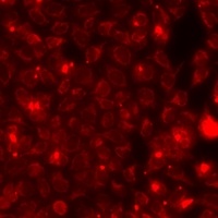 NGAL Rabbit Polyclonal Antibody