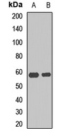 UAP1 Rabbit Polyclonal Antibody