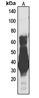 UBB Rabbit Polyclonal Antibody