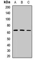 MTA3 Rabbit Polyclonal Antibody