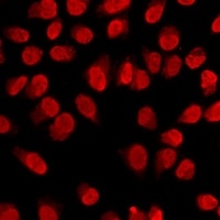 Histone H3 (MonoMethyl-K4) Antibody