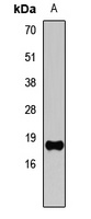Histone H3 (TriMethyl-K4) Antibody