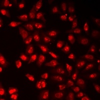 Histone H3 (TriMethyl-K9) Antibody