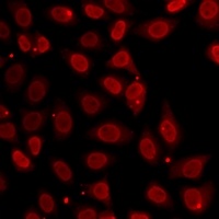 Histone H3 (TriMethyl-K27) Antibody