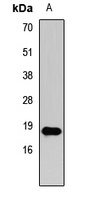 Histone H3 (TriMethyl-K27) Antibody