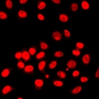 Histone H3 (TriMethyl-K27) Antibody