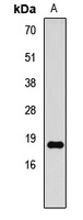 Histone H3 (DiMethyl-K79) Antibody