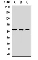 Squalene Epoxidase Rabbit Polyclonal Antibody