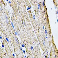 Filamin B Rabbit Polyclonal Antibody